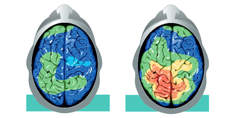 diagram of brain before and after running